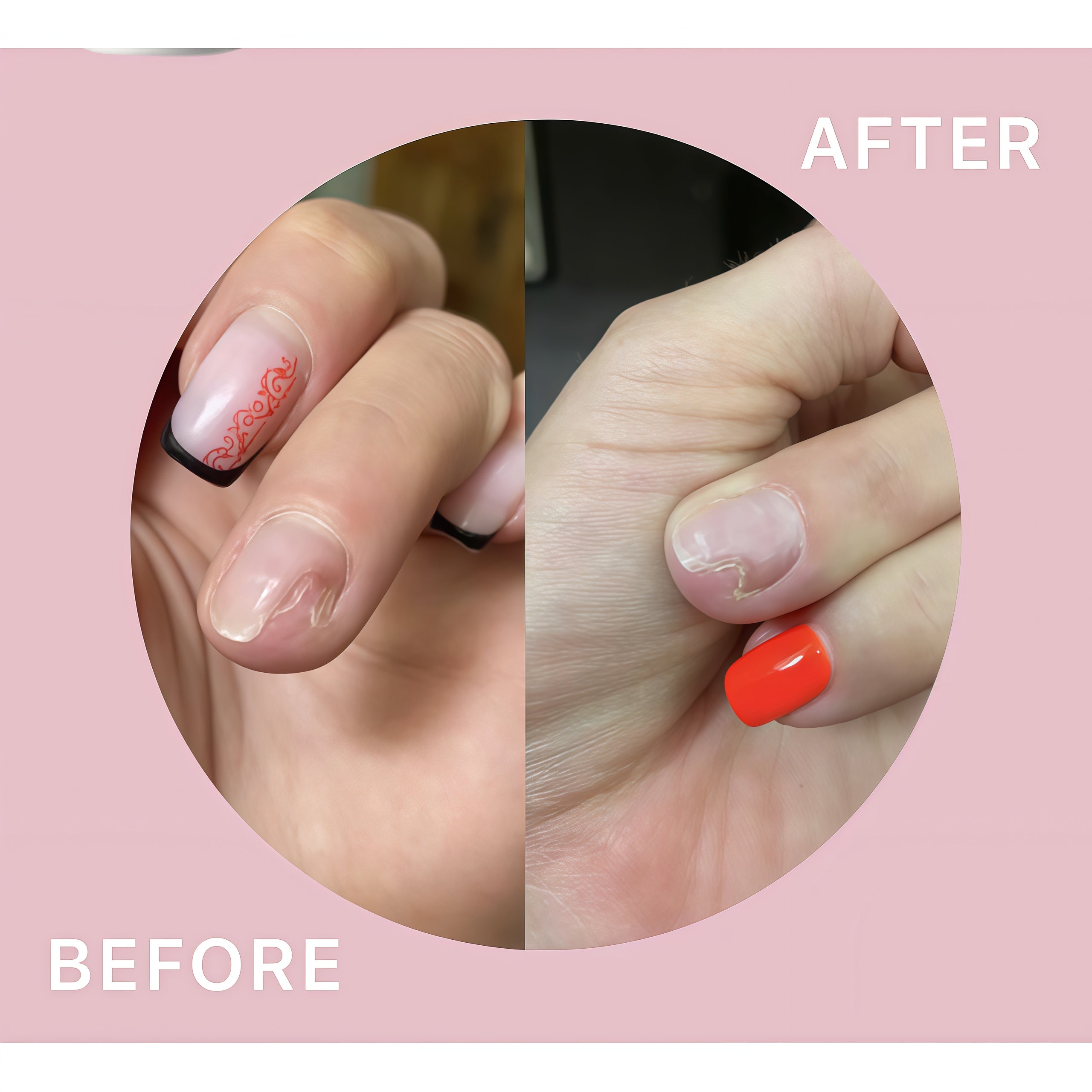 Shelly Restorative Nail Oil for Weakened & Delamination-Prone Nails with Farnesol & Tea Tree - 30 ml | Stop Onycholysis Nail Recovery Oil